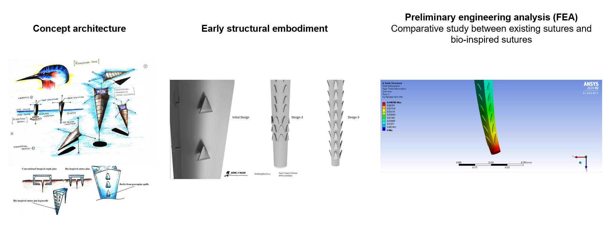 painless suture pins