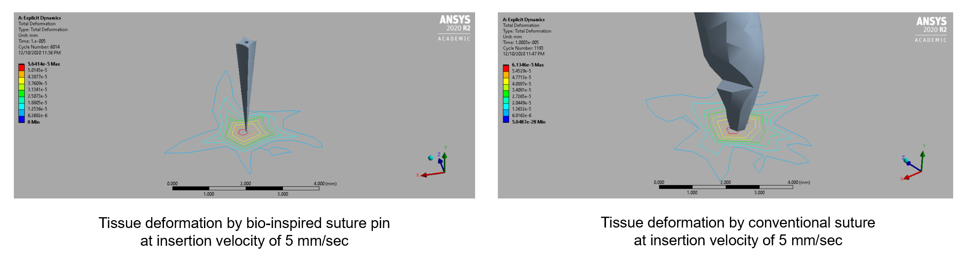 painless suture pins - analysis
